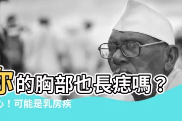 【胸部 長痣】你的胸部也長痣嗎？小心！可能是乳房疾病的徵兆！