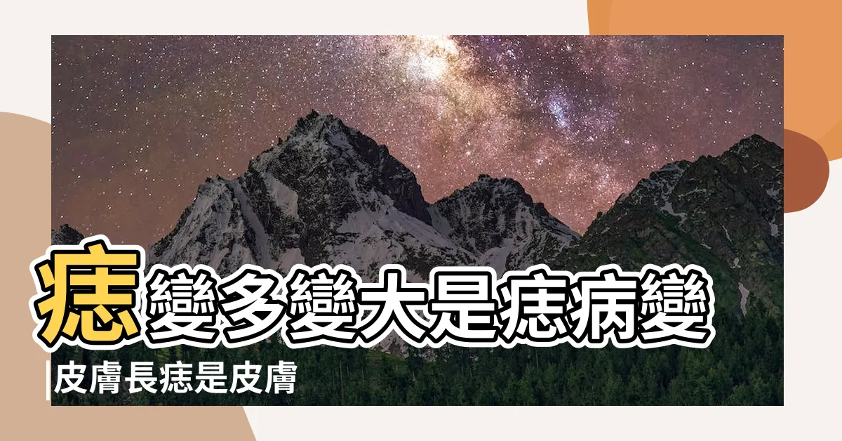 【長出痣】痣變多變大是痣病變 |皮膚長痣是皮膚癌嗎 |醫生揭痣長這裏致死率超高5種痣隨時變 |