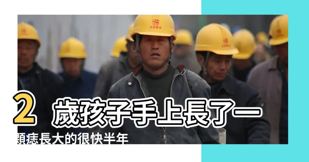 2歲孩子手上長了一顆痣長大的很快半年從一個小點 |孩子黑痣長大家長擔心惡變醫生 |搜索結果 |【小孩手背長黑痣】