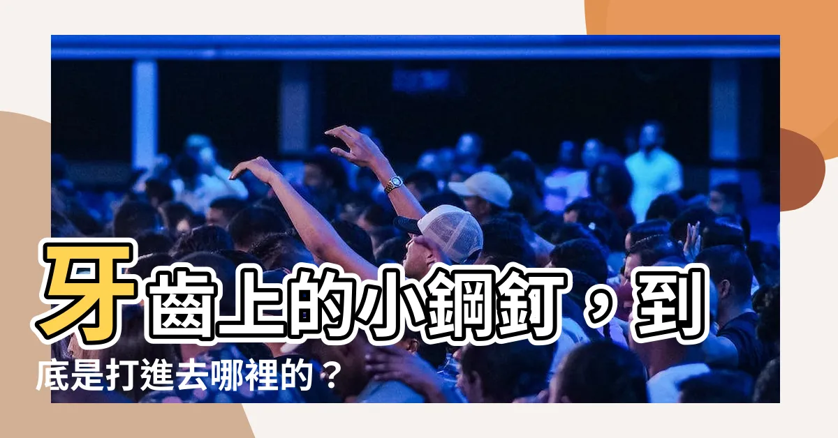 【打釘子】牙齒上的小鋼釘，到底是打進去哪裡的？牙齒鑽釘子真的不會痛？