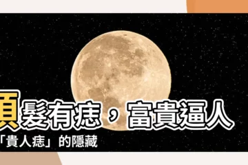 【頭髮裡有痣】頭髮有痣，富貴逼人！「貴人痣」的隱藏位置，讓你看見就招財！