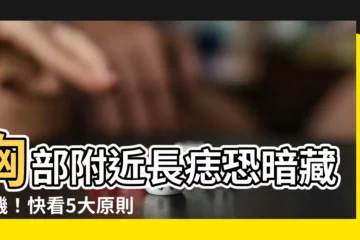 【胸部附近長痣】胸部附近長痣恐暗藏危機！快看5大原則辨別紅痣好壞