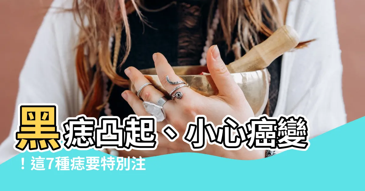 【痣 凸起】黑痣凸起、小心癌變！這7種痣要特別注意，及早預防很關鍵！