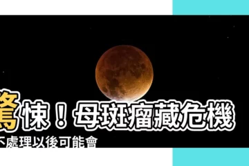 【母斑瘤】驚悚！母斑瘤藏危機，不處理以後可能會後悔！