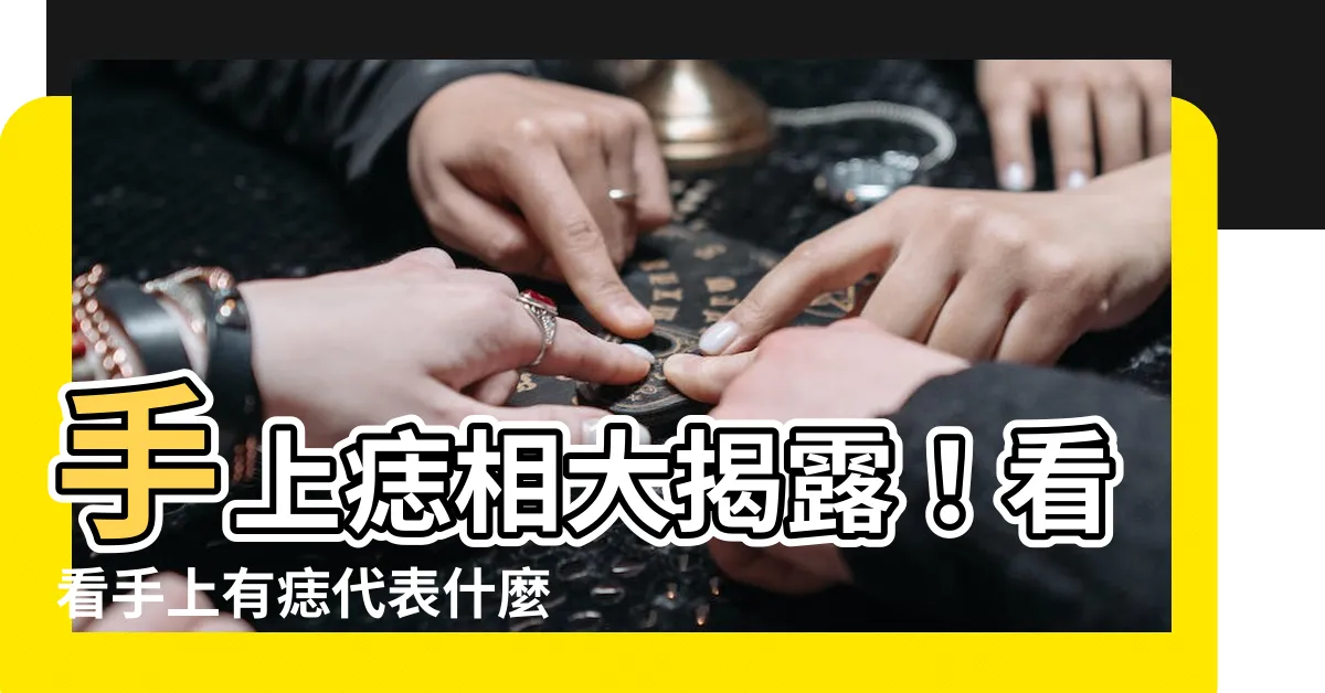 【手上有痣代表什麼】手上痣相大揭露！看看手上有痣代表什麼意義？