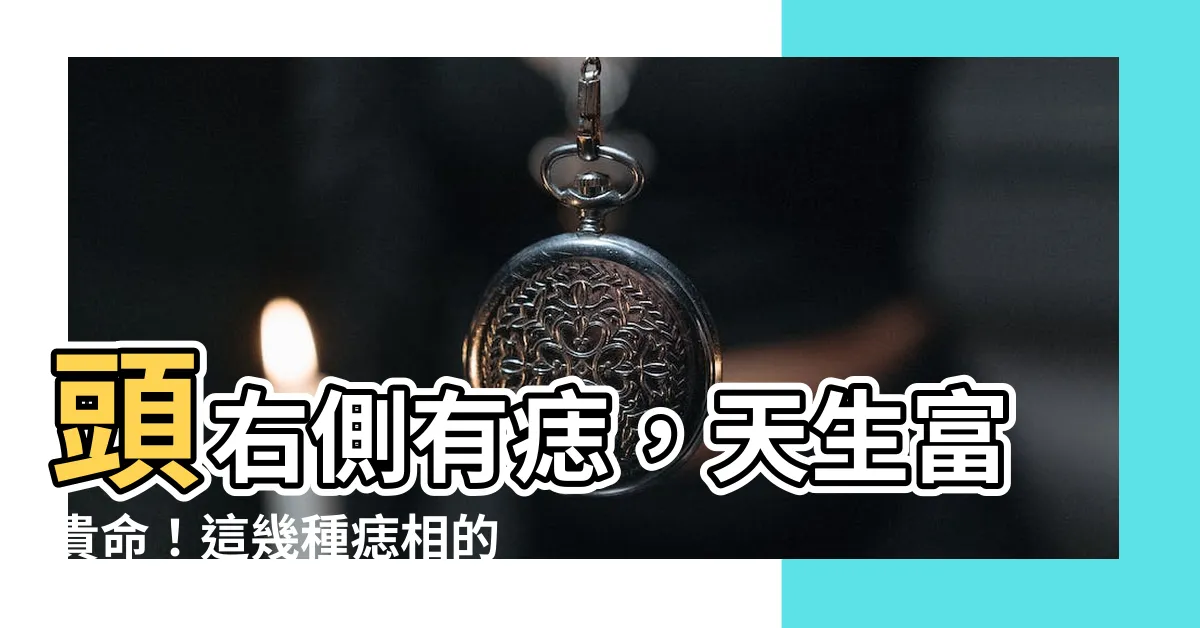 【頭右側有痣】頭右側有痣，天生富貴命！這幾種痣相的女人，財運亨通
