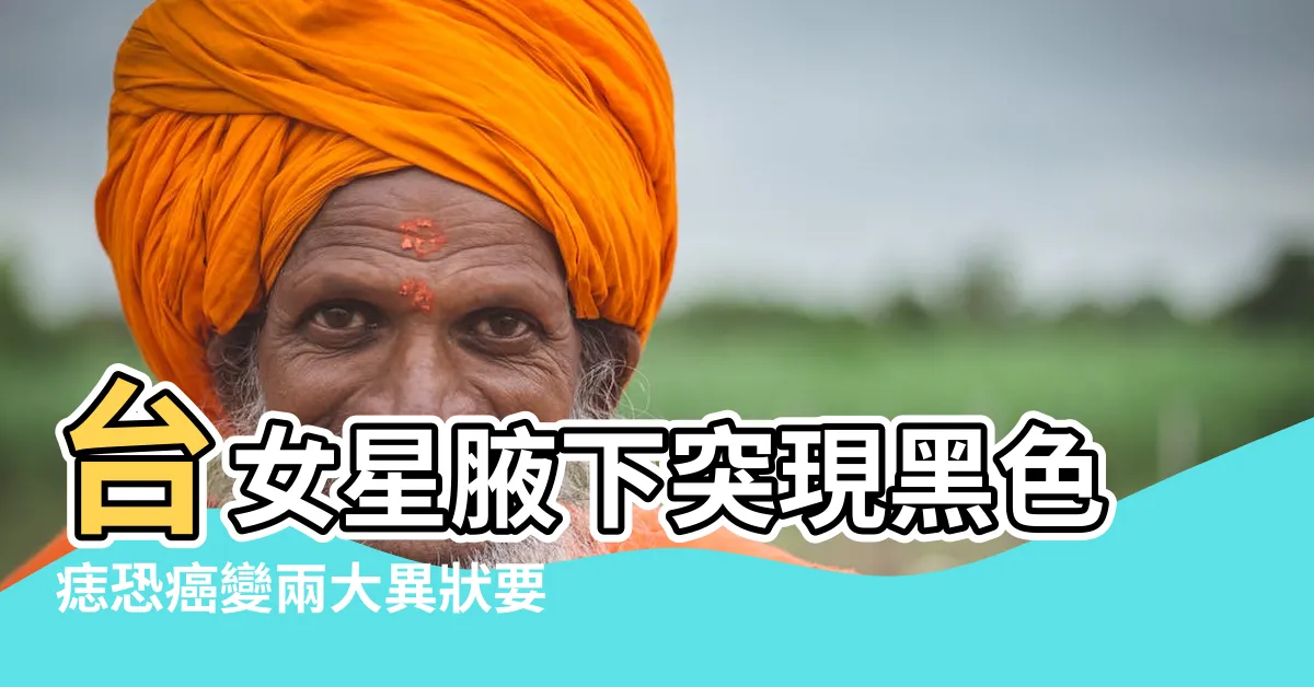 【腋下痣癌】台女星腋下突現黑色痣恐癌變兩大異狀要留心 |台女星腋下生黑痣恐變癌症做切除手術後籲小心2大 |致死率高 |