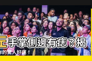 【左手掌側邊有痣】左手掌側邊有痣？揭曉你的驚人好運！
