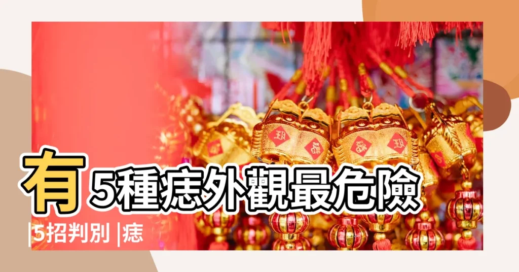 有5種痣外觀最危險 |5招判別 |痣形成的原因 |【身上有很多痦子】