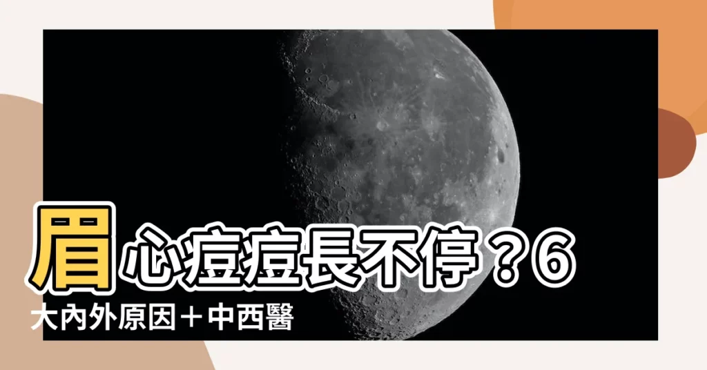 【眉心長痘痘原因】眉心痘痘長不停？6大內外原因＋中西醫治療全解析！