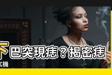 【下巴突然長痣】下巴突現痣？揭密痣相玄機