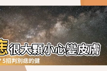 【痣很大顆】痣很大顆小心變皮膚癌？5招判別痣的健康狀況