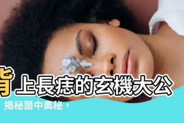 【背有痣】背上長痣的玄機大公開！揭秘箇中奧秘，見痣知人生！