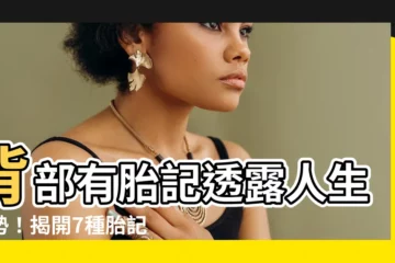 【背部有胎記】背部有胎記透露人生運勢！揭開7種胎記位置好壞大解密