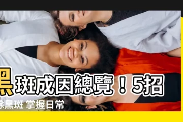 【黑斑原因】黑斑成因總覽！5招消除黑斑 掌握日常防範秘訣