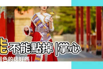 【棕色的痣是好不好】能不能點掉 |掌心有褐色的痣好嗎 |身上7種痣一定會癌變 |
