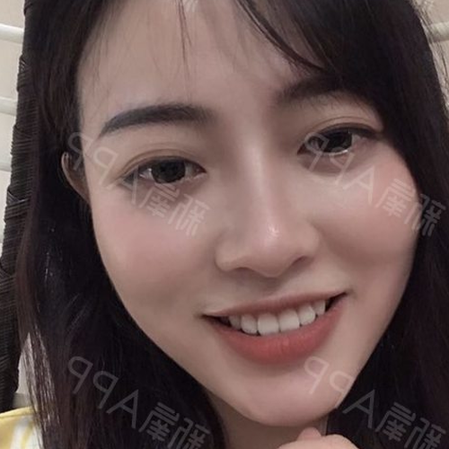 3、下牙不露怎麼能說話?