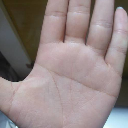 3、斷了右手的狗娘命運如何?