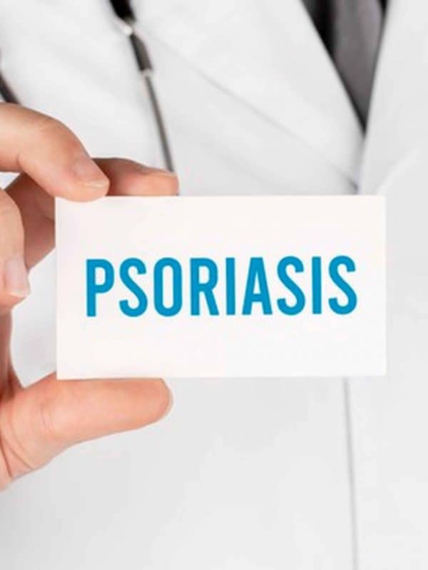 Psoriazis