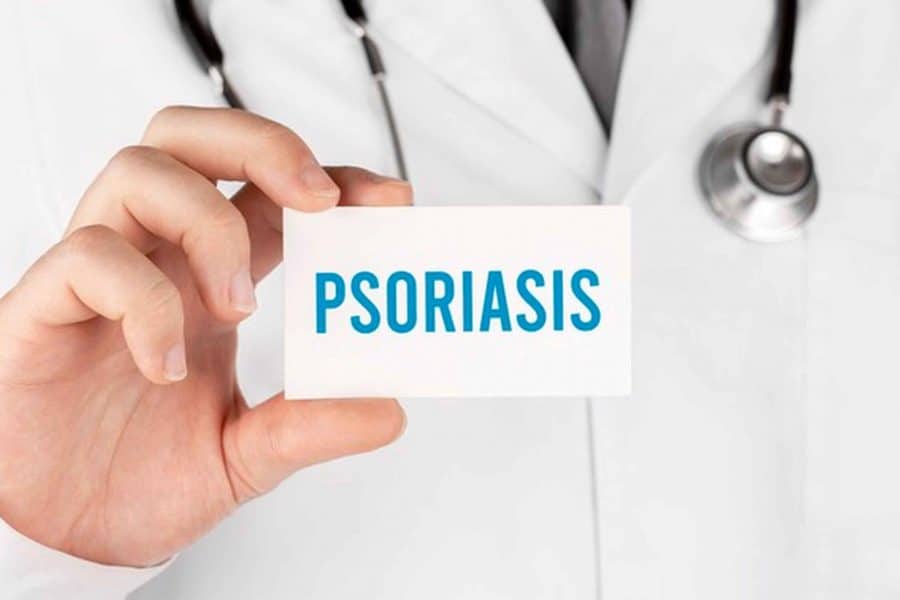 Psoriazis