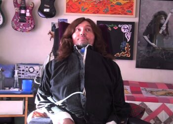 Músicos que vencieron problemas físicos