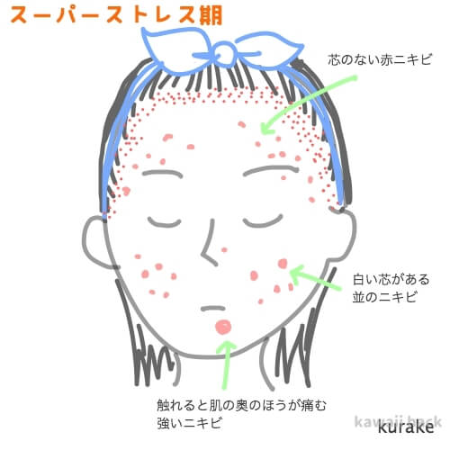 湯の花を顔に塗った経過