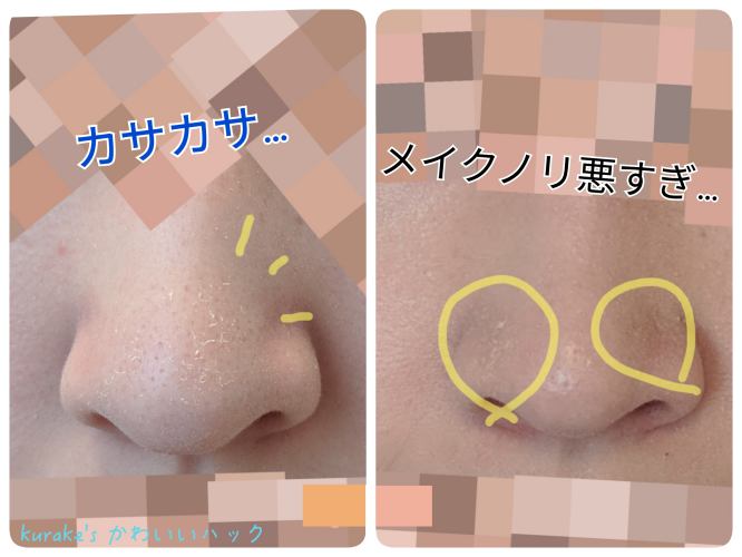 オバジcの酵素パウダーのレビュー 使う頻度によっては皮剥けまくり かわいいハック