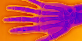 Radiology in the spotlight at PMH