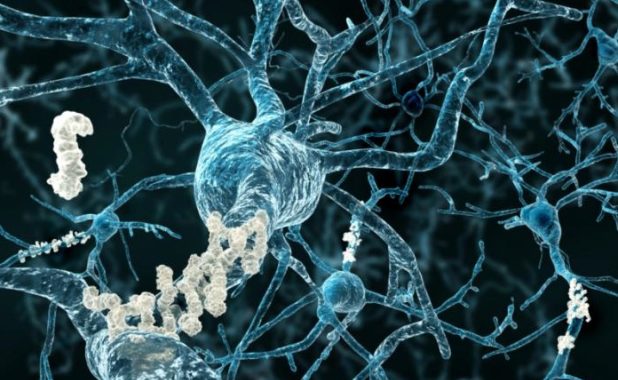 This New Breakthough Alzheimer’s Treatment Fully Restores Memory Function