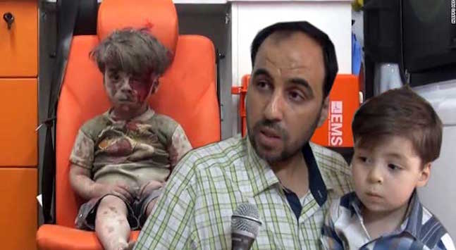 Father Of Famous Aleppo Boy Just Exposed How The US & White Helmets Lied To The World