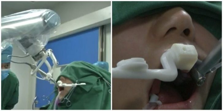 Meet the World’s First Robot to Fit 3D-Printed Teeth Into a Human’s Mouth