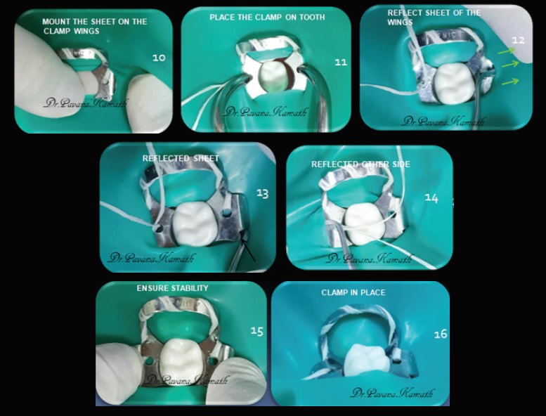 Crampon clema diga Brinker ginigval tissue retractors