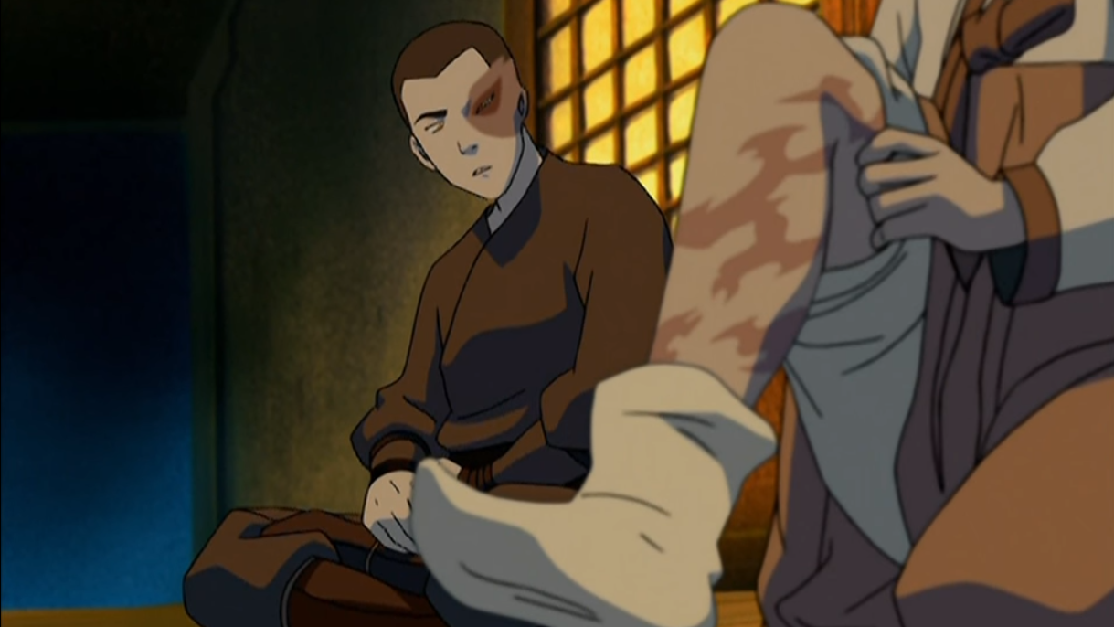 Song shows her scar to Zuko.