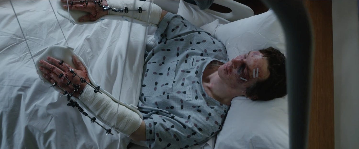 Benedict Cumberbatch as Stephen Strange laying in a hospital bed after his car crash, with stabilizing stints in his hands.