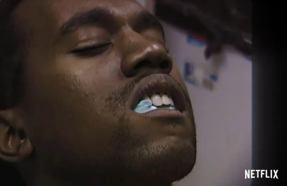 A close-up shot of Kanye West getting his teeth molded after recovering from his car accident where his jaw had to be wired shut.