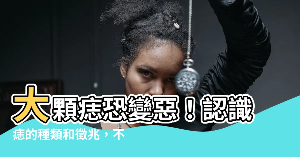 【大顆痣】大顆痣恐變惡！認識痣的種類和徵兆，不可忽視的癌症警訊