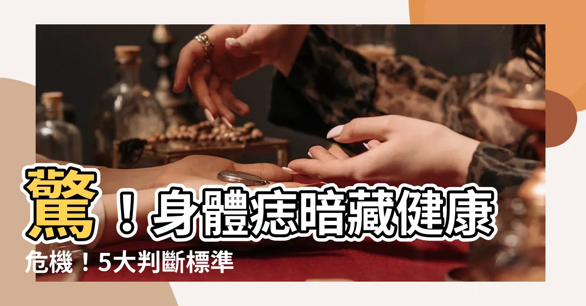 【身體痣】驚！身體痣暗藏健康危機！5大判斷標準秒懂痣病變！