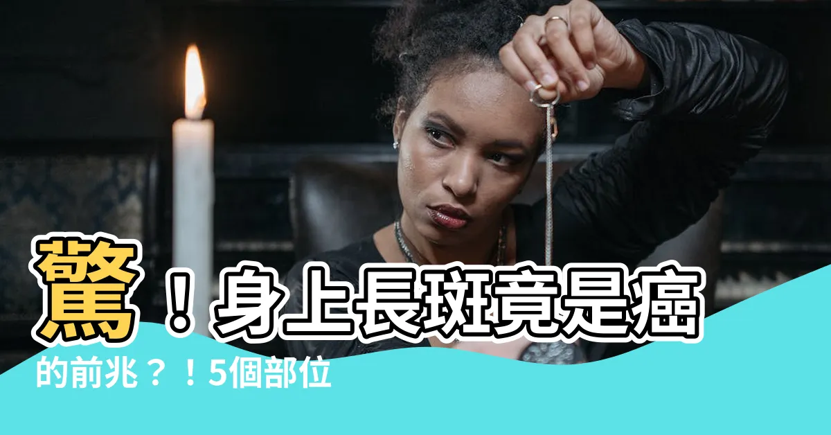 【身上長斑】驚！身上長斑竟是癌的前兆？！5個部位冒斑小心記這口訣防曬抗癌