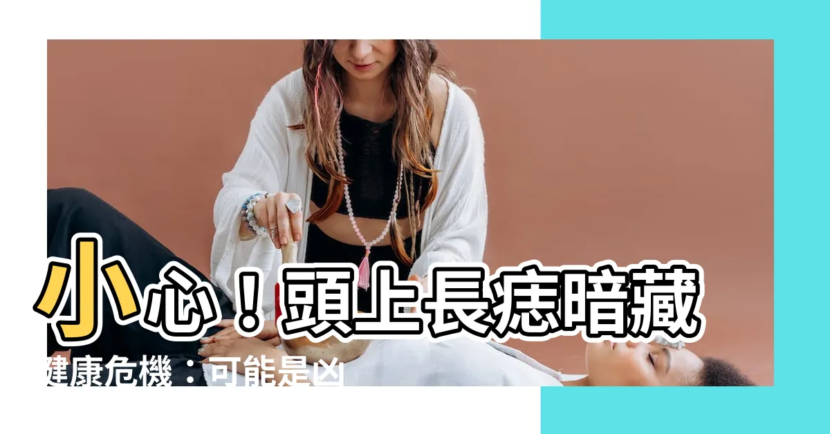 【頭長痣】小心！頭上長痣暗藏健康危機：可能是凶兆、也可能是福氣？