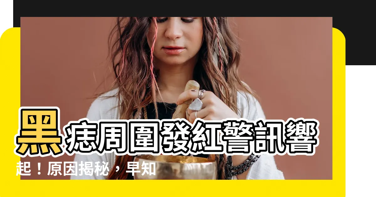 【痣周圍發紅】黑痣周圍發紅警訊響起！原因揭秘，早知早治療