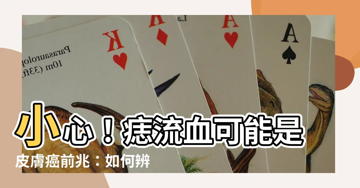 【痣流血】小心！痣流血可能是皮膚癌前兆：如何辨識ABCDE原則