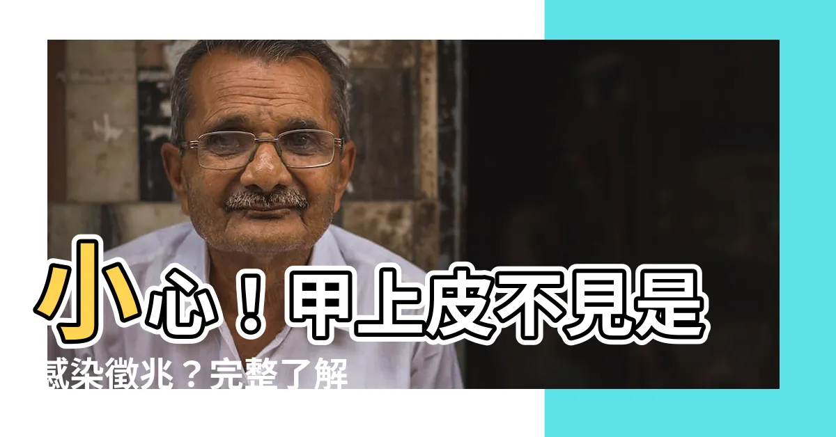 【甲上皮不見】小心！甲上皮不見是感染徵兆？完整瞭解甲上皮功能，避免指甲問題