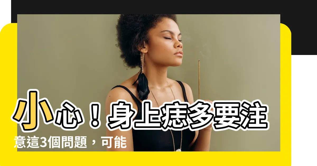 【身上痣多】小心！身上痣多要注意這3個問題，可能增加癌變風險