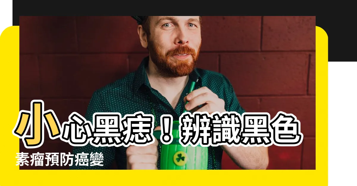【黑痣】小心黑痣！辨識黑色素瘤預防癌變