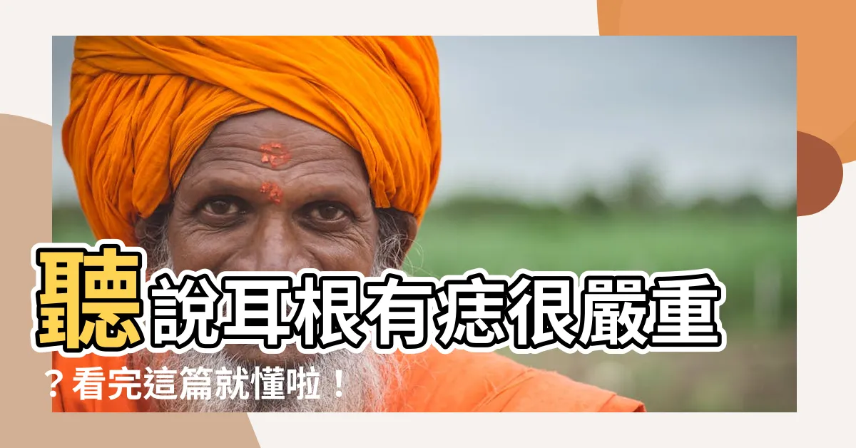 【耳根有痣】聽説耳根有痣很嚴重？看完這篇就懂啦！