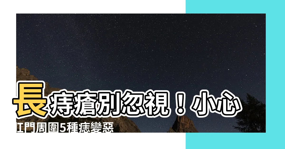 【長痔】長痔瘡別忽視！小心肛門周圍5種痣變惡化 導致死亡風險大增