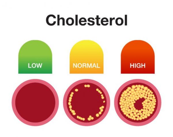 ระดับคอเลสเตอรอล (Cholesterol) ในร่างกายสูงปกติ 