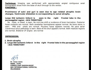 Brain Problem