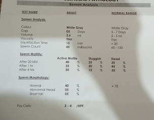 Sperm Count Test