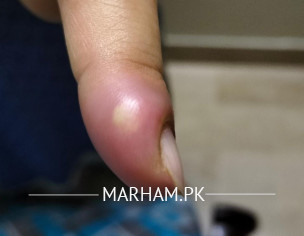 Finger Problem